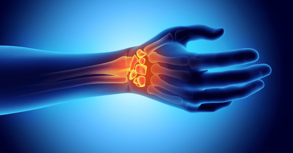 Relief in Days, Not Weeks: A Carpal Tunnel Health Event with Dr. H. Matthew Quitkin